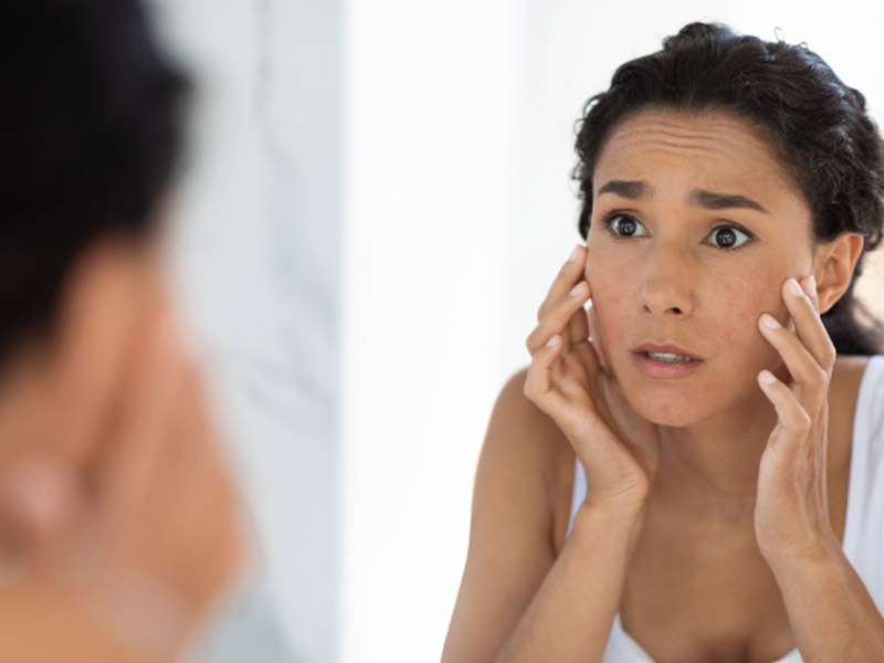 know-if-skin-products-cause-acne-from-divine-dermatology