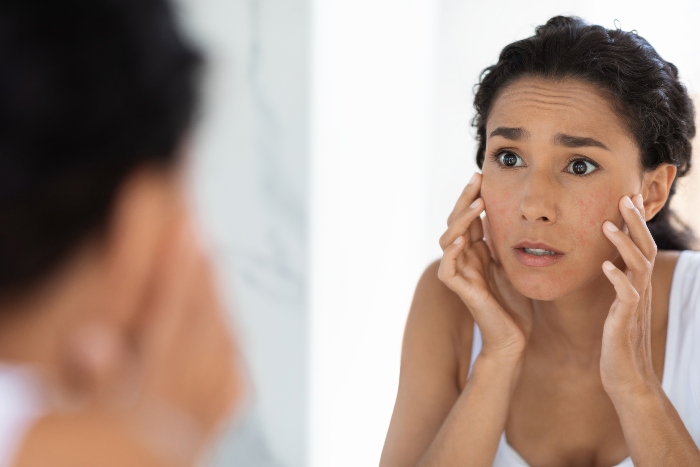 Know If Skin Products Cause Acne From Divine Dermatology